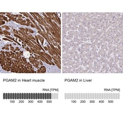 PGAM2 Antibody, Novus Biologicals:Antibodies:Primary Antibodies